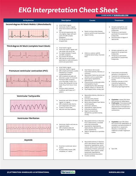 12 lead ekg interpretation cheat sheet.